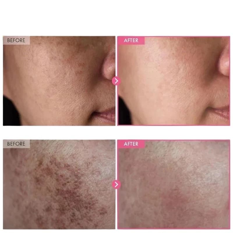Arbutin 7% + Tranexamic Acid 4% Cream | Brightening Moisturizer for Dark Spots, Uneven Tone & Hydration | 50g