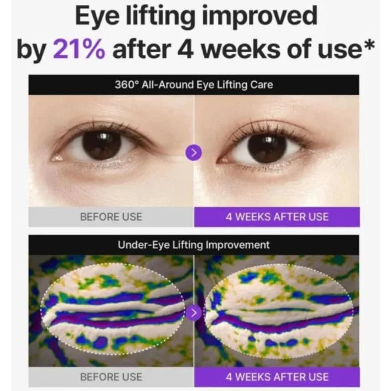 Centellian24 360° Shot PDRN Lifting Eye Cream | Anti-Aging Eye Cream for Wrinkles, Puffiness & Dark Circles | Firming & Hydrating Formula | 30ml