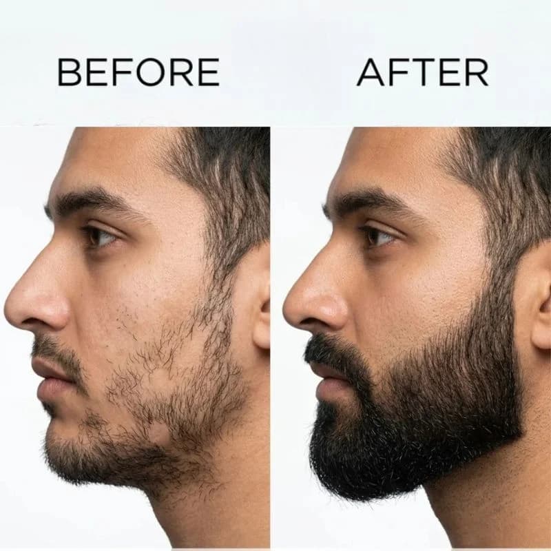 Dr. Alies Professional Beard Growth Oil | Natural Beard Care Oil for Patchy & Thin Beards | Moisturizing, Itch & Dandruff Care | 30ml