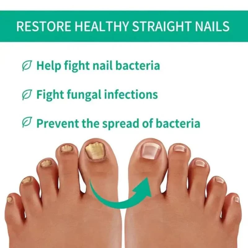 Fast Nail Fungus Treatment Serum | Nail Repair Essence for Fingernails & Toenails | Natural Nail Care Formula