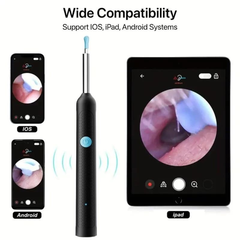 Smart Visual Ear Cleaner with 1080P HD Camera | Wireless Ear Wax Removal Otoscope | LED Ear Cleaning Tool for Android & iOS | Rechargeable & Portable